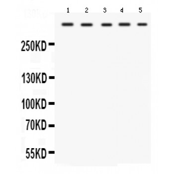 TRIO Antibody - Western blot analysis of TRIO expression in rat cardiac muscle extract (lane 1), rat skeletal muscle extract (lane 2), mouse cardiac muscle extract (lane 3), mouse skeletal muscle extract (lane 4) and HELA whole cell lysates (lane 5). TRIO at 347 kD was detected using rabbit anti- TRIO Antigen Affinity purified polyclonal antibody at 0.5 ug/mL. The blot was developed using chemiluminescence (ECL) method.