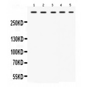 TRIO Antibody - Western blot analysis of TRIO expression in rat cardiac muscle extract (lane 1), rat skeletal muscle extract (lane 2), mouse cardiac muscle extract (lane 3), mouse skeletal muscle extract (lane 4) and HELA whole cell lysates (lane 5). TRIO at 347 kD was detected using rabbit anti- TRIO Antigen Affinity purified polyclonal antibody at 0.5 ug/mL. The blot was developed using chemiluminescence (ECL) method.