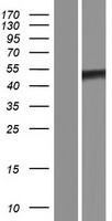 TRIOBP Protein - Western validation with an anti-DDK antibody * L: Control HEK293 lysate R: Over-expression lysate