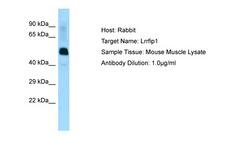 TRIP / LRRFIP1 Antibody -  This image was taken for the unconjugated form of this product. Other forms have not been tested.