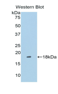 TRIP / LRRFIP1 Antibody - Western blot of recombinant TRIP / LRRFIP1.  This image was taken for the unconjugated form of this product. Other forms have not been tested.