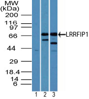 TRIP / LRRFIP1 Antibody - Western blot of LRRFIP1 in human heart lysate using 1) pre-bleed and 2) Polyclonal Antibody to LRRFIP1, and Polyclonal Antibody to LRRFIP1 in 3) mouse heart lysate at 3 and 5 ug/ml, respectively. Goat anti-rabbit Ig HRP secondary antibody, and PicoTect ECL substrate solution, were used for this test.