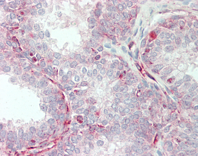 TRIP / LRRFIP1 Antibody - Human Prostate: Formalin-Fixed, Paraffin-Embedded (FFPE).  This image was taken for the unconjugated form of this product. Other forms have not been tested.