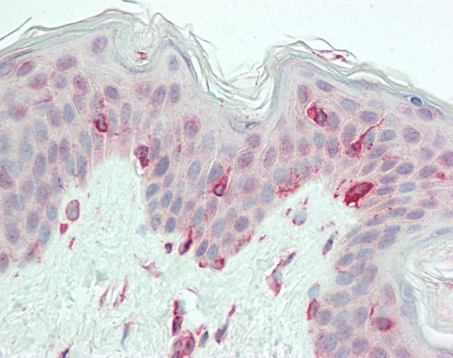 TRIP / LRRFIP1 Antibody - Human Skin: Formalin-Fixed, Paraffin-Embedded (FFPE).  This image was taken for the unconjugated form of this product. Other forms have not been tested.