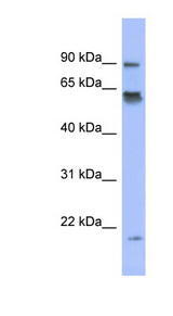 TRIP / LRRFIP1 Antibody - LRRFIP1 antibody Western blot of NCI-H226 cell lysate. This image was taken for the unconjugated form of this product. Other forms have not been tested.