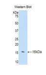 TRIP / LRRFIP1 Antibody - Western blot of recombinant TRIP / LRRFIP1.  This image was taken for the unconjugated form of this product. Other forms have not been tested.