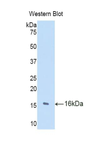 TRIP / LRRFIP1 Antibody - Western blot of recombinant TRIP / LRRFIP1.  This image was taken for the unconjugated form of this product. Other forms have not been tested.
