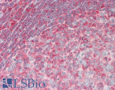 TRIP / LRRFIP1 Antibody - Human Tonsil: Formalin-Fixed, Paraffin-Embedded (FFPE).  This image was taken for the unconjugated form of this product. Other forms have not been tested.