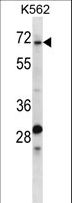 TRIP10 / CIP4 Antibody - TRIP10 Antibody western blot of K562 cell line lysates (35 ug/lane). The TRIP10 antibody detected the TRIP10 protein (arrow).