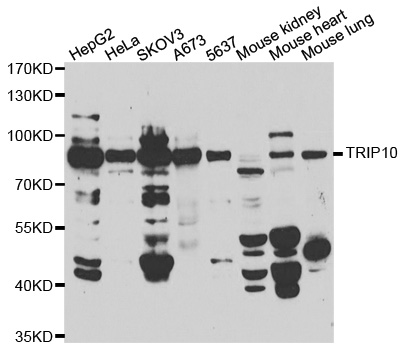 TRIP10 / CIP4 Antibody - Western blot analysis of extracts of various cell lines.
