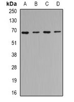 TRIP10 / CIP4 Antibody - Western blot analysis of CIP4 expression in HeLa (A); SKOV3 (B); mouse kidney (C); mouse heart (D) whole cell lysates.