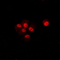 TRIP10 / CIP4 Antibody - Immunofluorescent analysis of CIP4 staining in U2OS cells. Formalin-fixed cells were permeabilized with 0.1% Triton X-100 in TBS for 5-10 minutes and blocked with 3% BSA-PBS for 30 minutes at room temperature. Cells were probed with the primary antibody in 3% BSA-PBS and incubated overnight at 4 deg C in a humidified chamber. Cells were washed with PBST and incubated with a DyLight 594-conjugated secondary antibody (red) in PBS at room temperature in the dark.