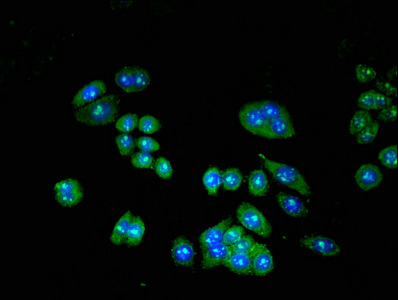 TRIP10 / CIP4 Antibody - Immunofluorescent analysis of PC3 Cells Cells at a dilution of 1:100 and Alexa Fluor 488-congugated AffiniPure Goat Anti-Rabbit IgG(H+L)