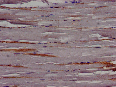TRIP10 / CIP4 Antibody - Immunohistochemistry image of paraffin-embedded human skeletal muscle tissue at a dilution of 1:100