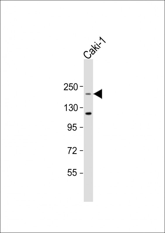 TRIP12 Antibody - Anti-TRIP12 Antibody (Center) at 1:2000 dilution + Caki-1 whole cell lysate Lysates/proteins at 20 ug per lane. Secondary Goat Anti-Rabbit IgG, (H+L), Peroxidase conjugated at 1:10000 dilution. Predicted band size: 220 kDa. Blocking/Dilution buffer: 5% NFDM/TBST.