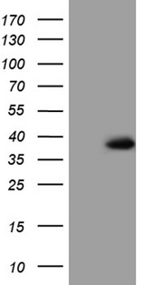 TRIP13 Antibody - HEK293T cells were transfected with the pCMV6-ENTRY control. (Left lane) or pCMV6-ENTRY TRIP13. (Right lane) cDNA for 48 hrs and lysed. Equivalent amounts of cell lysates. (5 ug per lane) were separated by SDS-PAGE and immunoblotted with anti-TRIP13. (1:2000)