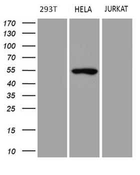 TRIP13 Antibody - Western blot analysis of extracts. (35ug) from 3 different cell lines by using anti-TRIP13 monoclonal antibody. (293T: human; HeLa: human; Jurkat: human; ). (1:500)