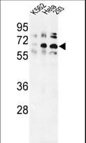 TRIP13 Antibody - Western blot of TRIP13 Antibody in K562, HeLa, 293 cell line lysates (35 ug/lane). TRIP13 (arrow) was detected using the purified antibody.