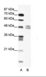TRIP13 Antibody - A: Marker, B: Jurkat Cell Lysate.  This image was taken for the unconjugated form of this product. Other forms have not been tested.