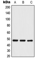 TRIP13 Antibody - Western blot analysis of TRIP13 expression in Jurkat (A); NIH3T3 (B); PC12 (C) whole cell lysates.