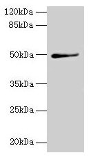 TRIP13 Antibody - Western blot All lanes: TRIP13 antibody at 1µg/ml + A549 whole cell lysate Secondary Goat polyclonal to rabbit IgG at 1/10000 dilution Predicted band size: 49, 23 kDa Observed band size: 49 kDa