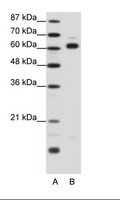 TRIP4 / ASC-1 Antibody - A: Marker, B: 293T Cell Lysate.  This image was taken for the unconjugated form of this product. Other forms have not been tested.