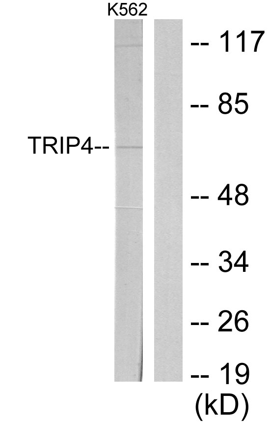 TRIP4 / ASC-1 Antibody - Western blot analysis of lysates from K562 cells, using TRIP4 Antibody. The lane on the right is blocked with the synthesized peptide.