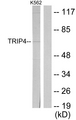 TRIP4 / ASC-1 Antibody - Western blot analysis of lysates from K562 cells, using TRIP4 Antibody. The lane on the right is blocked with the synthesized peptide.