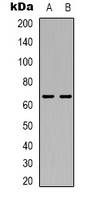 TRIP4 / ASC-1 Antibody - Western blot analysis of ASC-1 expression in HeLa (A); A549 (B) whole cell lysates.