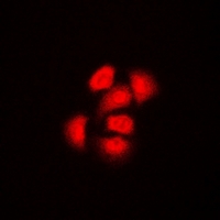 TRIP4 / ASC-1 Antibody - Immunofluorescent analysis of ASC-1 staining in HeLa cells. Formalin-fixed cells were permeabilized with 0.1% Triton X-100 in TBS for 5-10 minutes and blocked with 3% BSA-PBS for 30 minutes at room temperature. Cells were probed with the primary antibody in 3% BSA-PBS and incubated overnight at 4 deg C in a humidified chamber. Cells were washed with PBST and incubated with a DyLight 594-conjugated secondary antibody (red) in PBS at room temperature in the dark. DAPI was used to stain the cell nuclei (blue).