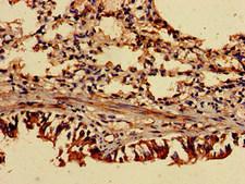 TRIP4 / ASC-1 Antibody - Immunohistochemistry of paraffin-embedded human lung tissue at dilution of 1:100
