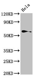 TRIP4 / ASC-1 Antibody - Western Blot Positive WB detected in:Hela whole cell lysate All Lanes:TRIP4 antibody at 4µg/ml Secondary Goat polyclonal to rabbit IgG at 1/50000 dilution Predicted band size: 67 KDa Observed band size: 67 KDa