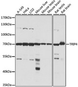 TRIP4 / ASC-1 Antibody - Western blot analysis of extracts of various cell lines, using TRIP4 antibody at 1:1000 dilution. The secondary antibody used was an HRP Goat Anti-Rabbit IgG (H+L) at 1:10000 dilution. Lysates were loaded 25ug per lane and 3% nonfat dry milk in TBST was used for blocking. An ECL Kit was used for detection and the exposure time was 30s.