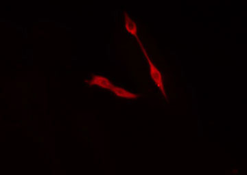 TRIP4 / ASC-1 Antibody - Staining HeLa cells by IF/ICC. The samples were fixed with PFA and permeabilized in 0.1% Triton X-100, then blocked in 10% serum for 45 min at 25°C. The primary antibody was diluted at 1:200 and incubated with the sample for 1 hour at 37°C. An Alexa Fluor 594 conjugated goat anti-rabbit IgG (H+L) antibody, diluted at 1/600, was used as secondary antibody.