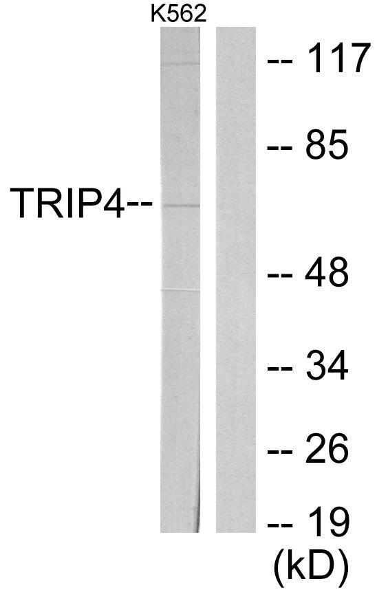 TRIP4 / ASC-1 Antibody - Western blot analysis of extracts from K562 cells, using TRIP4 antibody.