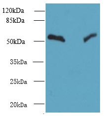 TRIT1 Antibody - Western blot. All lanes: TRIT1 antibody at 3 ug/ml. Lane 1: Jurkat whole cell lysate. Lane 2: Raji whole cell lysate. Secondary Goat polyclonal to Rabbit IgG at 1:10000 dilution. Predicted band size: 53 kDa. Observed band size: 53 kDa.
