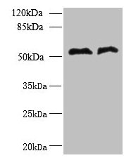 TRIT1 Antibody - Western blot All lanes: TRIT1 antibody at 3µg/ml Lane 1: Jurkat whole cell lysate Lane 2: Raji whole cell lysate Secondary Goat polyclonal to rabbit IgG at 1/10000 dilution Predicted band size: 53, 38, 50, 44, 19 kDa Observed band size: 53 kDa