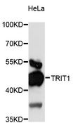 TRIT1 Antibody - Western blot analysis of extracts of HeLa cells, using TRIT1 antibody at 1:3000 dilution. The secondary antibody used was an HRP Goat Anti-Rabbit IgG (H+L) at 1:10000 dilution. Lysates were loaded 25ug per lane and 3% nonfat dry milk in TBST was used for blocking. An ECL Kit was used for detection and the exposure time was 15s.