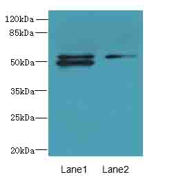 TRM6 / TRMT6 Antibody - Western blot. All lanes: TRMT6 antibody at 4 ug/ml. Lane 1: U251 whole cell lysate. Lane 2: HepG-2 whole cell lysate. Secondary Goat polyclonal to Rabbit IgG at 1:10000 dilution. Predicted band size: 56 kDa. Observed band size: 56 kDa.