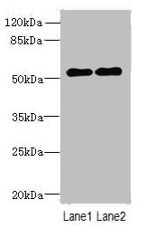 TRM6 / TRMT6 Antibody - Western blot All lanes: TRMT6 antibody at 4µg/ml Lane 1: U251 whole cell lysate Lane 2: HepG2 whole cell lysate Secondary Goat polyclonal to rabbit IgG at 1/10000 dilution Predicted band size: 56, 45, 41, 37 kDa Observed band size: 56 kDa