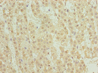 TRM6 / TRMT6 Antibody - Immunohistochemistry of paraffin-embedded human adrenal gland tissue using TRMT6 Antibody at dilution of 1:100
