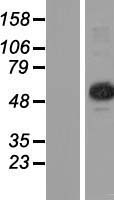 TRM6 / TRMT6 Protein - Western validation with an anti-DDK antibody * L: Control HEK293 lysate R: Over-expression lysate