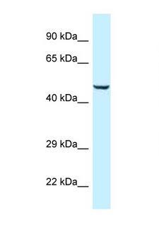 TRMO / C9orf156 Antibody - C9orf156 antibody Western blot of Fetal Heart lysate. Antibody concentration 1 ug/ml.  This image was taken for the unconjugated form of this product. Other forms have not been tested.