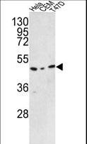TRMO / C9orf156 Antibody - Western blot of C9orf156 Antibody in HeLa, CEM, T47D cell line lysates (35 ug/lane). C9orf156 (arrow) was detected using the purified antibody.