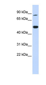 TRMT1 Antibody - TRMT1 antibody Western blot of 293T cell lysate. This image was taken for the unconjugated form of this product. Other forms have not been tested.