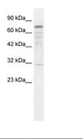 TRMT1 Antibody - Jurkat Cell Lysate.  This image was taken for the unconjugated form of this product. Other forms have not been tested.