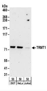 TRMT1 Antibody - Detection of Human TRMT1 by Western Blot. Samples: Whole cell lysate (50 ug) from 293T, HeLa, and Jurkat cells. Antibodies: Affinity purified rabbit anti-TRMT1 antibody used for WB at 1 ug/ml. Detection: Chemiluminescence with an exposure time of 3 minutes.