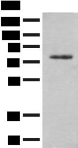 TRMT1 Antibody - Western blot analysis of Hela cell lysate  using TRMT1 Polyclonal Antibody at dilution of 1:300