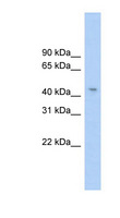 TRMT10C / RG9MTD1 Antibody - RG9MTD1 antibody Western blot of HeLa lysate. This image was taken for the unconjugated form of this product. Other forms have not been tested.