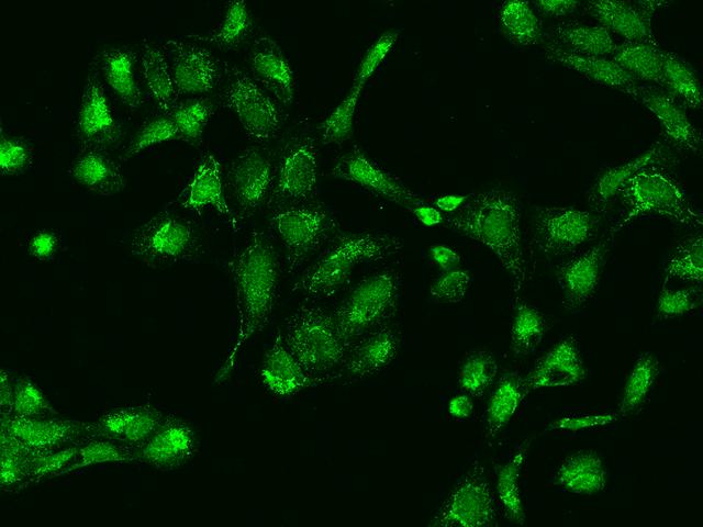 TRMT10C / RG9MTD1 Antibody - Immunofluorescence staining of RG9MTD1 in U2OS cells. Cells were fixed with 4% PFA, permeabilzed with 0.1% Triton X-100 in PBS, blocked with 10% serum, and incubated with rabbit anti-Human RG9MTD1 polyclonal antibody (dilution ratio 1:200) at 4°C overnight. Then cells were stained with the Alexa Fluor 488-conjugated Goat Anti-rabbit IgG secondary antibody (green). Positive staining was localized to Nucleus and Cytoplasm.